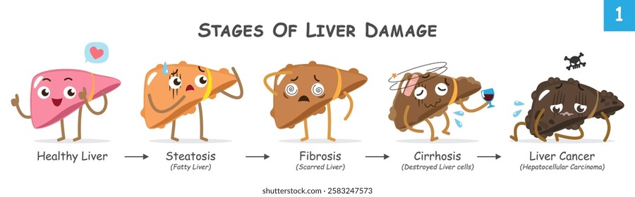 Stages of liver damage . Collection of cute medical cartoon characters about progression of liver disease . Vector .