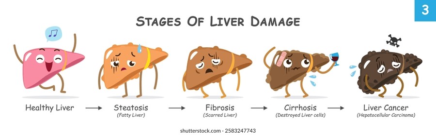 Stages of liver damage . Collection of cute medical cartoon characters about progression of liver disease . Vector .