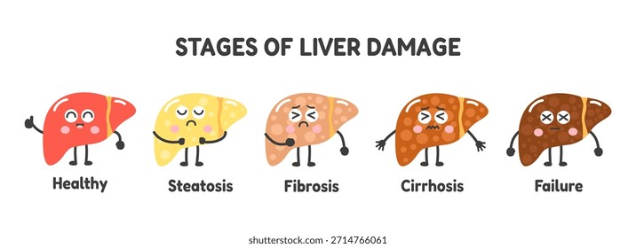 Stages of liver damage illustration set. Characters depicting healthy organ, steatosis, fibrosis, cirrhosis, and liver failure. Medical infographic, hepatitis, fatty liver disease, and alcohol abuse concept. Cute cartoon vector illustration.