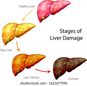 16,209 Liver disease vector Images, Stock Photos & Vectors | Shutterstock