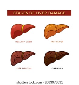 Stages Liver Damage Vector Illustration Stock Vector (Royalty Free ...