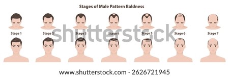 The stages of male pattern baldness vector illustration isolated on white background. The Norwood scale defines seven stages of male pattern hair loss or androgenetic alopecia. Hair care concept.