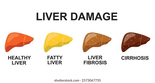 Stages of nonalcoholic liver damage. Healthy, fatty, fibrosis, cirrhosis. Liver Disease. Isolated vector illustration in flat style on white background