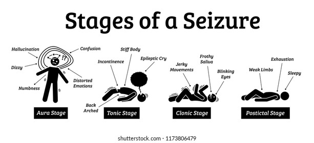 Stages and phases of a seizure. Illustrations depicts the phases when a person get a seizure which are the aura, tonic, clonic, and postictal stages.