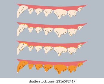 Stages of plaque and tartar formation in dogs. Gum disease prevention. Dog dental care concept. Vector illustration