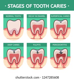 How Brush Your Teeth Instruction Infographics Stock Vector (Royalty ...