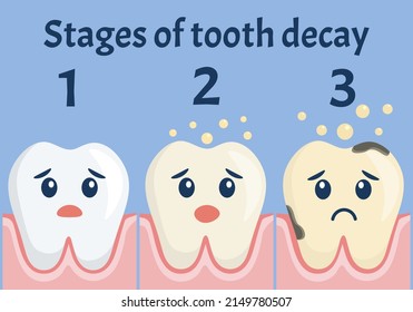 Stages of tooth decay concept. Flat design. Cute teeth with faces.