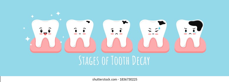 Stages of tooth decay in gum icon set. Cute kawaii teeth on different stages of dental caries development. Flat cartoon emoji character vector illustration. Kids dental hygiene and treatment concept.