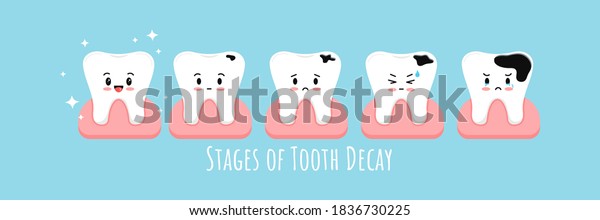 歯茎の減衰の段階 ガムアイコンセット う蝕の発達段階のかわいいかわいい歯 漫画の絵文字のベクターイラスト 歯の衛生と治療のコンセプト のベクター画像素材 ロイヤリティフリー