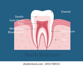 Las etapas de la caries dental, la Ilustración vectorial