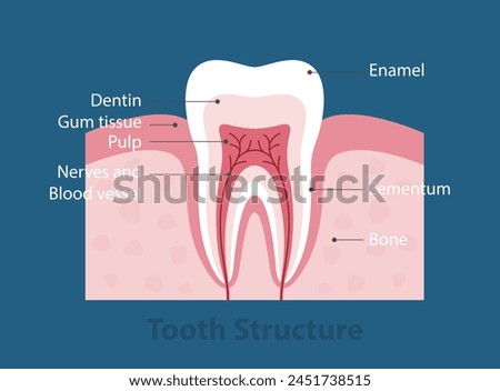 The stages of tooth decay, vector illustration