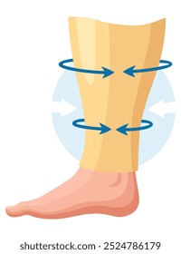 Etapas o tipos de desarrollo de las venas varicosas. Cartel médico o infografía de enfermedades. Imagen de piernas enfermas. Ilustración vectorial en estilo plano