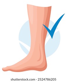Etapas o tipos de desarrollo de las venas varicosas. Cartel médico o infografía de enfermedades. Imagen de piernas sanas. Ilustración vectorial en estilo plano