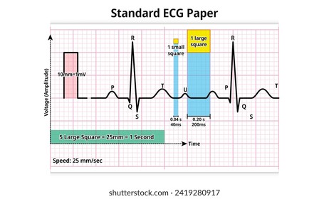 Standard-EKG-Papier - Gitter von Quadraten, die sich mit einer Geschwindigkeit von 25 mm pro Sekunde und einer Spannung von 10 mm pro mV bewegen - Elektronische Vektorgrafik