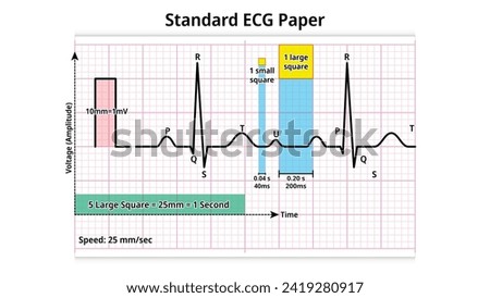 Standard ECG Paper - grid of squares that moves at a speed of 25 mm per seconds and a voltage of 10 mm per mV - Electrocardiogram Medical Vector Illustration