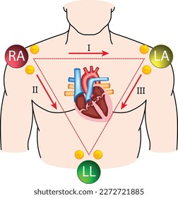 Standard Limb Leads ECG - Einthoven Triangle - Electrocardiogram - Medical Vector Illustration