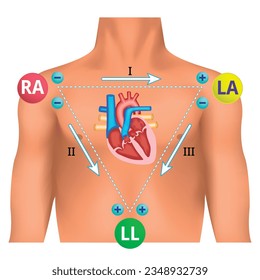 Standard Limb Leads ECG - Einthoven Triangle - Electrocardiogram Lead Position - Medical Vector Illustration