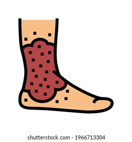 stasis dermatitis color icon vector. stasis dermatitis sign. isolated symbol illustration