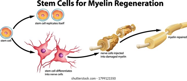 Stem cell for myelin regeneration illustration