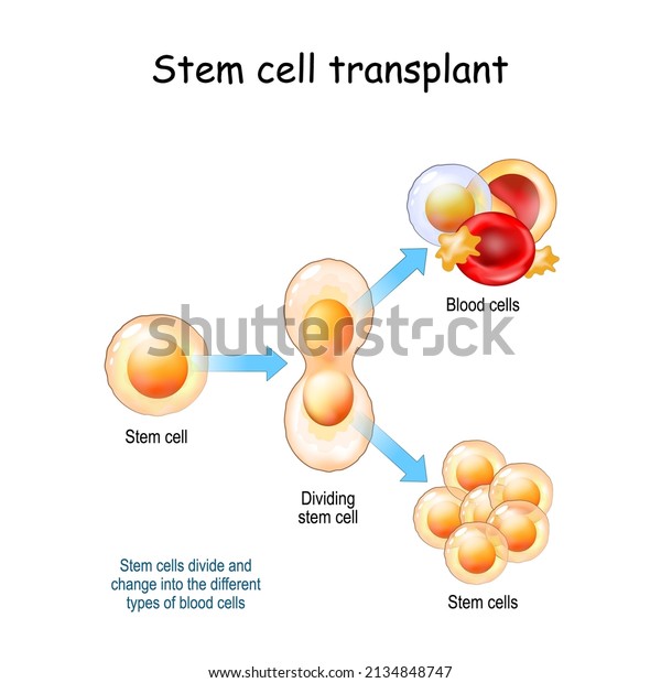 Stem cell\
transplant. Stem cells divide and change into the different types\
of blood cells. Vector\
illustration