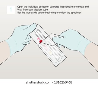 Step 1 : Open the individual collection package that contains the swab and Viral Transport Medium tube.