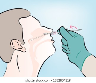 step 4 : Gently insert the swab into the nostril. Keep the swab near the septum floor of the nose while gently pushing the swab into the post nasopharynx.