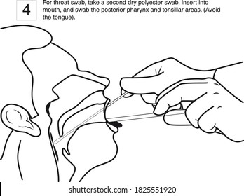 step 4 : For throat swab, take a second dry polyester swab, insert into mouth, and swab the posterior pharynx and tonsillar areas. line drawing