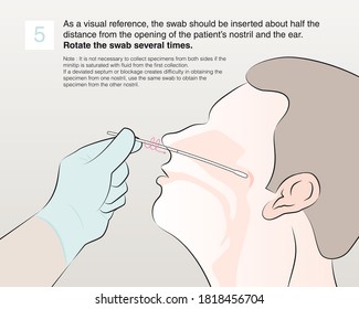 Step 5 : As a visual reference, the swab should be inserted about half the distance from the opening of the patient’s nostril and the ear. Rotate the swab several times.