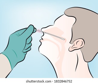 Step 5 : As a visual reference, the swab should be inserted about half the distance from the opening of the patient’s nostril and the ear. Rotate the swab several times.