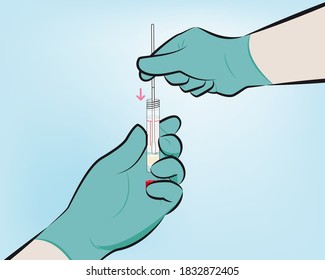 Step 6 : While holding the swab in the same hand, aseptically remove the cap from the tube. Insert the swab into the tube with the transport medium.