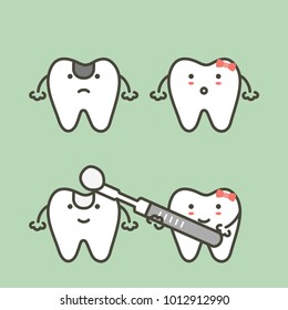 step of decay tooth to teeth filling, before and after - dental cartoon vector flat style cute character for design