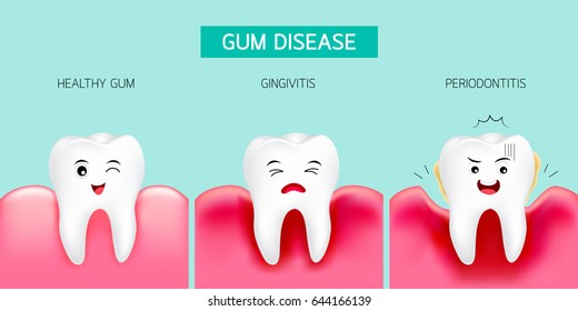 Step of gum disease. Healthy tooth and gingivitis.. Cute cartoon design, illustration isolated on green background. Dental care concept.