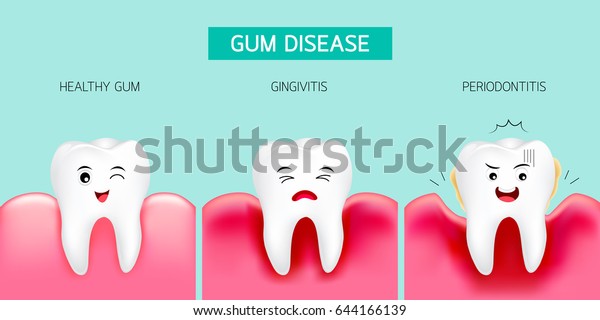 Step of gum disease. Healthy tooth and\
gingivitis.. Cute cartoon design, illustration isolated on green\
background. Dental care\
concept.