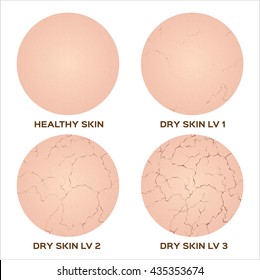 step of healthy to dry skin without moisturizer texture , vector icon