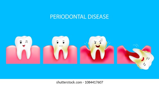 歯周病 の画像 写真素材 ベクター画像 Shutterstock