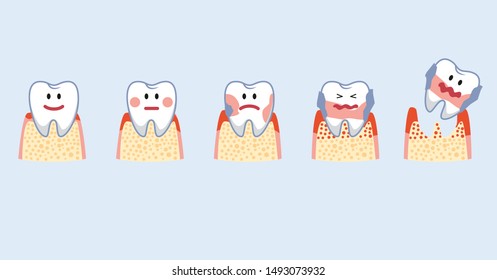step of periodontal disease in vector funny illustration.