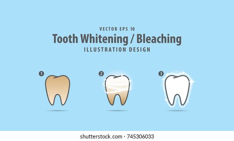 Step of single tooth Whitening-Bleaching illustration vector on blue background. Dental concept.