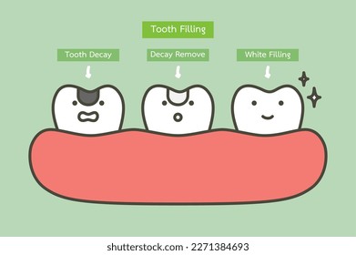 step of tooth amalgam filling by dental tools to protection decay tooth, before and after - teeth cartoon vector flat style cute character for design