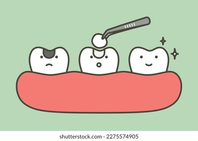 paso de la amalgama dental rellenando con herramientas dentales para proteger el diente de descomposición, antes y después - dibujos animados dentarios estilo plano lindo personaje para el diseño