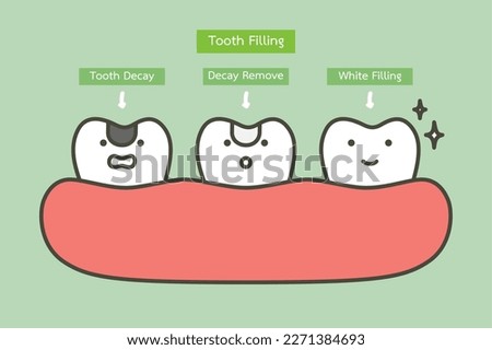 step of tooth amalgam filling by dental tools to protection decay tooth, before and after - teeth cartoon vector flat style cute character for design