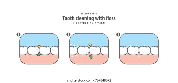 Step of tooth cleaning with floss illustration vector on white background. Dental concept.