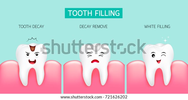 歯の充填のステップ 虫歯 虫歯除去 白い充填 緑の背景にかわいい漫画のデザイン イラトス 歯科ケアのコンセプト のベクター画像素材 ロイヤリティフリー