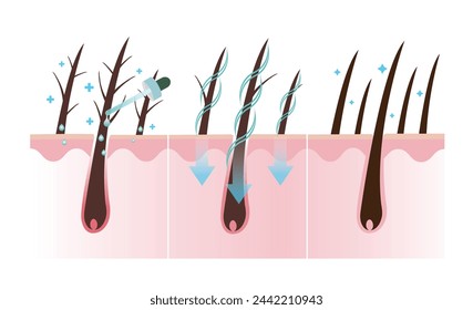 Step of treat damaged hair vector isolated on white background. The mechanism of split ends hair treatment and healthy hair scalp layer. Hair care concept illustration.