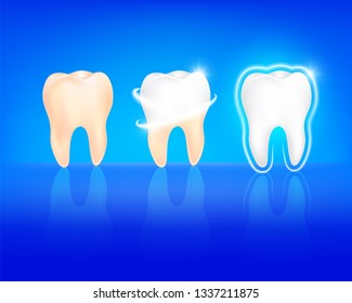 step of whitening tooth. Teeth Whitening. Dental care Concept. Illustration isolated on blue background. 