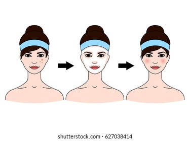 Step-by-step use of facial masks from acne on white background.