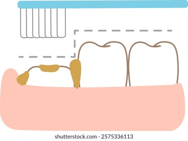 The step-like unevenness of 6-year molars, which are difficult to clean with a toothbrush, and tips for brushing them.