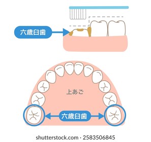 The step-like unevenness of 6-year molars, which are difficult to clean with a toothbrush, and tips for brushing them.[Translate]Permanent first molar,Upper teeth