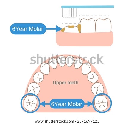 The step-like unevenness of 6-year molars, which are difficult to clean with a toothbrush, and tips for brushing them.