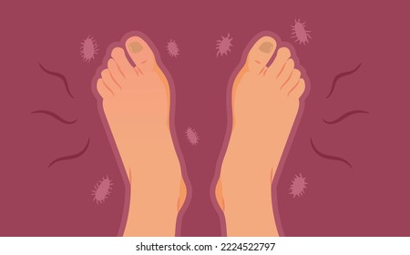 
Stinky Feet Unprotected from Bacteria Problems Vector illustration. Person with bacterial infection suffering uncomfortable symptoms 
