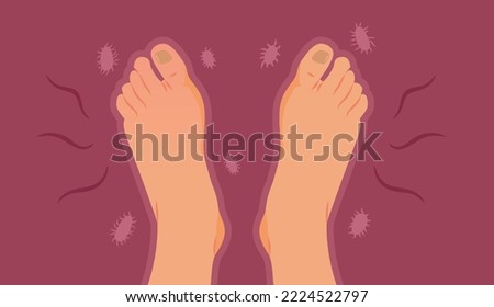 
Stinky Feet Unprotected from Bacteria Problems Vector illustration. Person with bacterial infection suffering uncomfortable symptoms 
